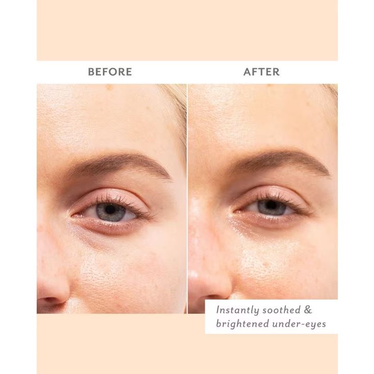 Patchology Skin Remedy Soothing Eye Gels